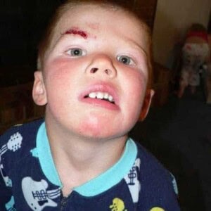 kiddo on mothers day and a trip to the ER